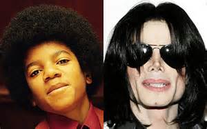 before after michael