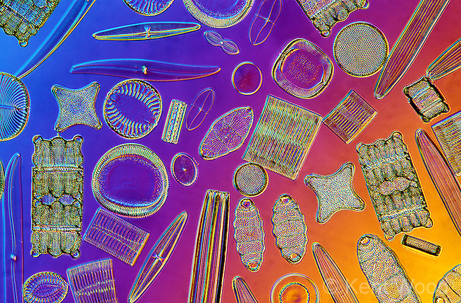 Radial and pennate diatoms as seen under a microscope with diffierential contrast  illumination.  Specimen preparation by the famous 19 th century Victorian mounting firm, W. H. Watson and Sons, Ltd. England. Diatoms are protists which have shells sculpted out of silicon oxide.  After the living protist has perished the shells remain.  These clear shells are comprised of two halves called valves.  Diatom shells and their corresponding patterns respond to beautifully and artfully to a variety of colorful microscopic illumination techniques.  Many are so intricately detailed that they have long been used as test objects for microscope objectives. There are two major classes of diatoms: centric and pennate.  Centric diatoms have patterns arranged radially, around a central point, known as radial symmetry. Pennate diatoms have bilateral symmetry, left and right matching halves, and are generally needle or boat shaped. When alive, diatoms are brownish green in color a live almost everywhere, from open waters to quiet shallows.  They may live alone or in colonies.   In the mid to late 19th century Victorian era mounters created patterns of them on microscope slides using micro manipulators. Diatoms are a favorite of microscopists for their beauty.  Originally they were used for testing the resolving power of objectives. These are highly sought after. Kingdom: Protists, Phylum: Bacillariophyta Photomicroscope I on Ektachrome Tungsten 35mm color film, with various  illuminations and colors at 40X, 80x on a 4x6 inch print.